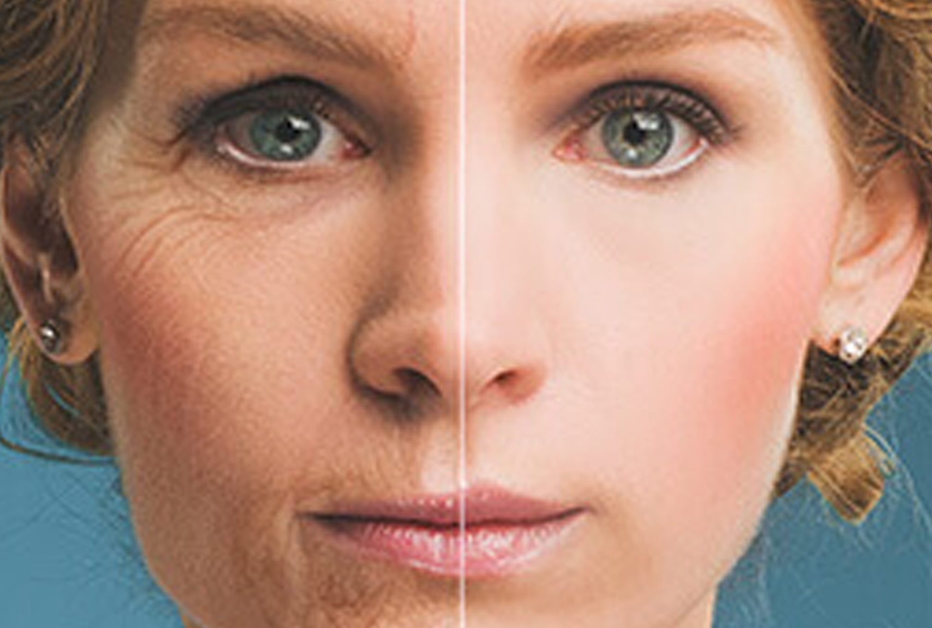 how prp theraphy works - before and after image