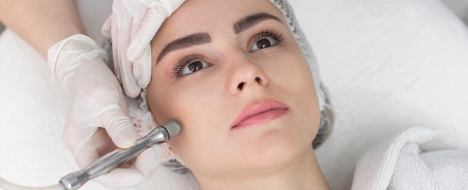 5 Benefits of Microdermabrasion