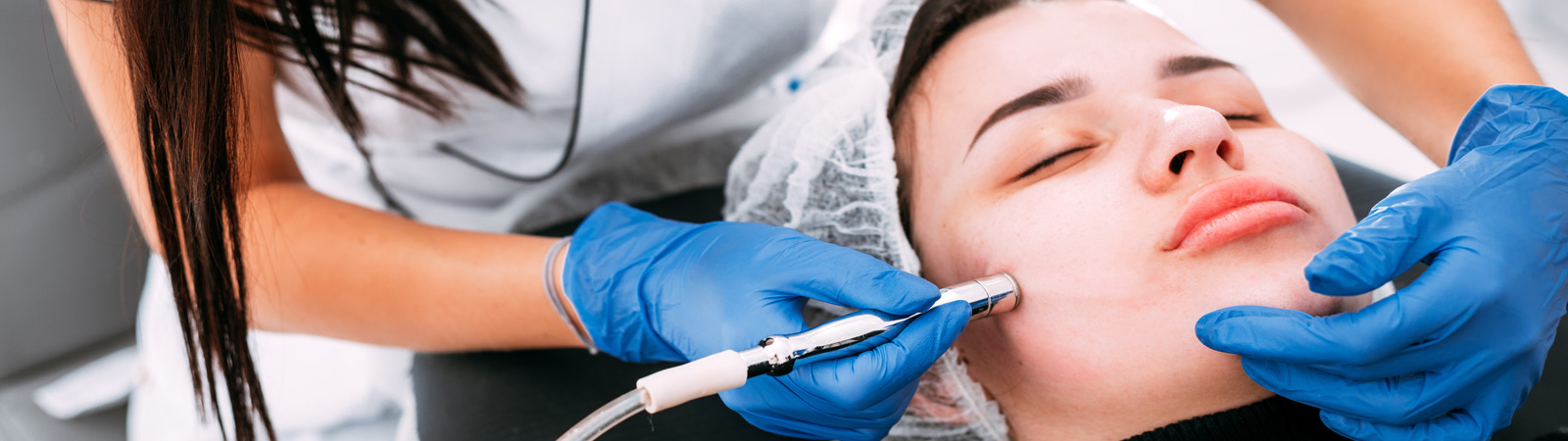 5 Cosmetic Concerns That Microdermabrasion Addresses